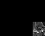 One of the first images acquired with Radarsat: Ross Island, Alaska, in 1997.
